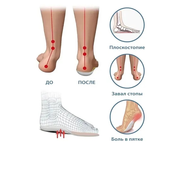 Стельки ортопедические ORTO-Toy